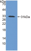 Polyclonal Antibody to Involucrin (INV)