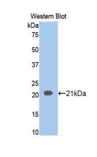 Polyclonal Antibody to Involucrin (INV)