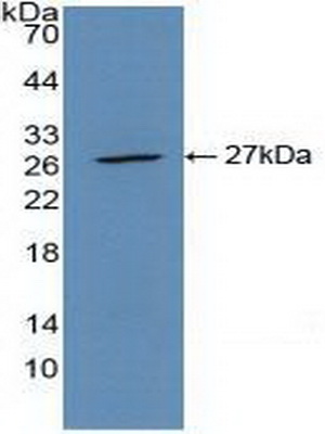 Polyclonal Antibody to Actin Alpha 2, Smooth Muscle (ACTa2)