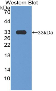 Polyclonal Antibody to Aryl Hydrocarbon Receptor (AhR)