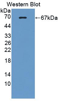 Polyclonal Antibody to Lactate Dehydrogenase A (LDHA)