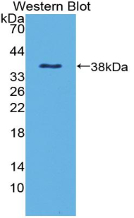 PAB373Hu01.jpg