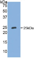 Polyclonal Antibody to Neutrophil gelatinase-associated lipocalin (NGAL)