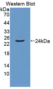 Polyclonal Antibody to Neutrophil gelatinase-associated lipocalin (NGAL)