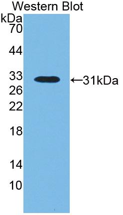 Polyclonal Antibody to Lipopolysaccharide Binding Protein (LBP)