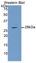 Polyclonal Antibody to Lipopolysaccharide Binding Protein (LBP)