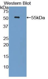 Polyclonal Antibody to Lipopolysaccharide Binding Protein (LBP)