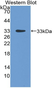 Polyclonal Antibody to Lipopolysaccharide Binding Protein (LBP)