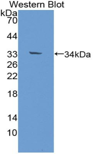 PAB422Hu01.jpg