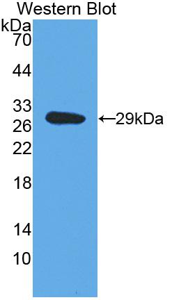 Polyclonal Antibody to Dopamine Beta Hydroxylase (DbH)