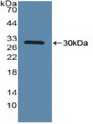 PAB460Hu01.jpg