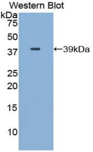 PAB462Hu01.jpg