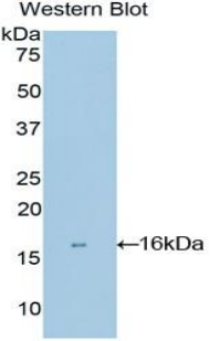 Polyclonal Antibody to Matrix Gla Protein (MGP)