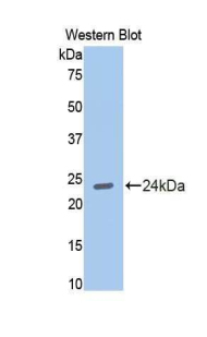 Polyclonal Antibody to N-cadherin (NCAD)