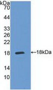 Polyclonal Antibody to Interleukin 5 Receptor Alpha (IL5Ra)