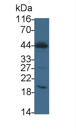 PAB512Hu01.jpg