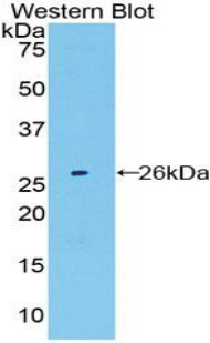 Polyclonal Antibody to Large Multifunctional Peptidase 7 (LMP7)