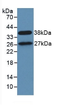 PAB588Hu01.jpg