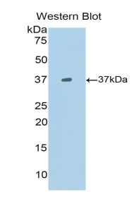 Polyclonal Antibody to B-Lymphocyte Chemoattractant (BLC)