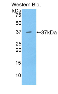 Polyclonal Antibody to B-Lymphocyte Chemoattractant (BLC)