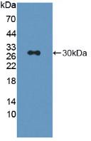 Polyclonal Antibody to Lymphocyte Activation Gene 3 (LAG3)