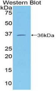 Polyclonal Antibody to Cluster Of Differentiation 146 (CD146)