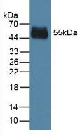 Polyclonal Antibody to Immunoglobulin G2 (IgG2)