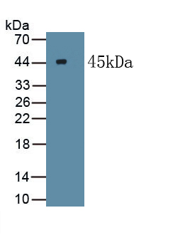 Polyclonal Antibody to Myogenic Differentiation (MyoD)