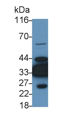 Polyclonal Antibody to Lactate Dehydrogenase B (LDHB)