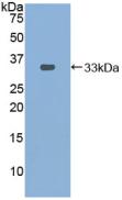 Polyclonal Antibody to Pyridoxal Kinase (PDXK)