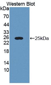 Polyclonal Antibody to Lectin Galactoside Binding, Soluble 3 Binding Protein (LGALS3BP)