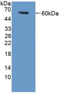 Polyclonal Antibody to Transglutaminase 1 (TGM1)