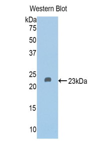 Polyclonal Antibody to Vitamin D Binding Protein (DBP)