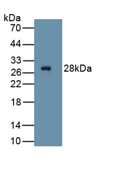 PAB813Hu01.jpg