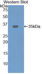 Polyclonal Antibody to Lectin Like Oxidized Low Density Lipoprotein Receptor 1 (LOX1)