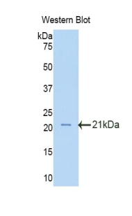 Polyclonal Antibody to Oxidosqualene Cyclase (OSC)