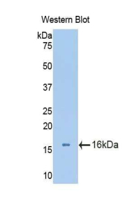 Polyclonal Antibody to Aggrecan (AGC)