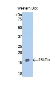 Polyclonal Antibody to Aggrecan (AGC)