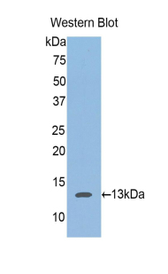 Polyclonal Antibody to Aggrecan (AGC)