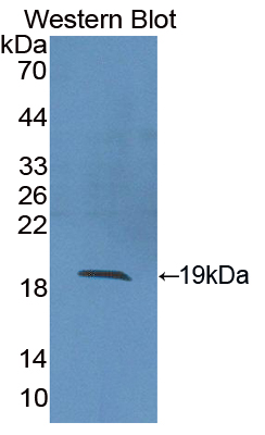 Polyclonal Antibody to Superoxide Dismutase 1 (SOD1)