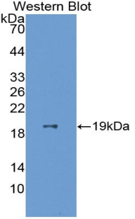 Polyclonal Antibody to Superoxide Dismutase 1 (SOD1)