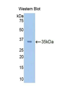 Polyclonal Antibody to Calpain 1 (CAPN1)