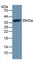 Polyclonal Antibody to Calpain 1 (CAPN1)