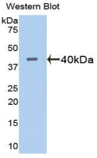 Polyclonal Antibody to A Disintegrin And Metalloproteinase With Thrombospondin 1 (ADAMTS1)