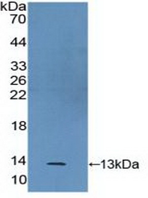 Polyclonal Antibody to S100 Calcium Binding Protein A2 (S100A2)