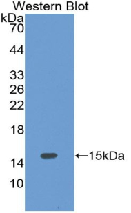 Polyclonal Antibody to Complement Factor B (CFB)