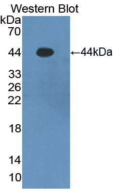 Polyclonal Antibody to S100 Calcium Binding Protein A7 (S100A7)