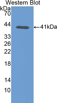 Polyclonal Antibody to Transferrin (TF)