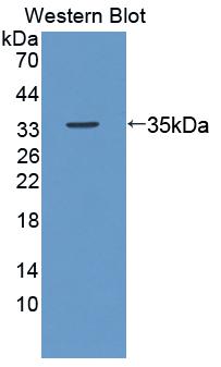 Polyclonal Antibody to Ki-67 Protein (Ki-67)