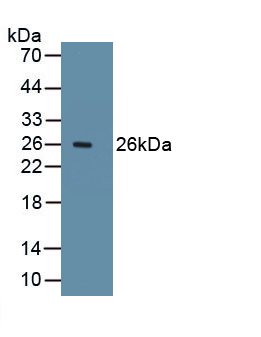 Polyclonal Antibody to Ki-67 Protein (Ki-67)